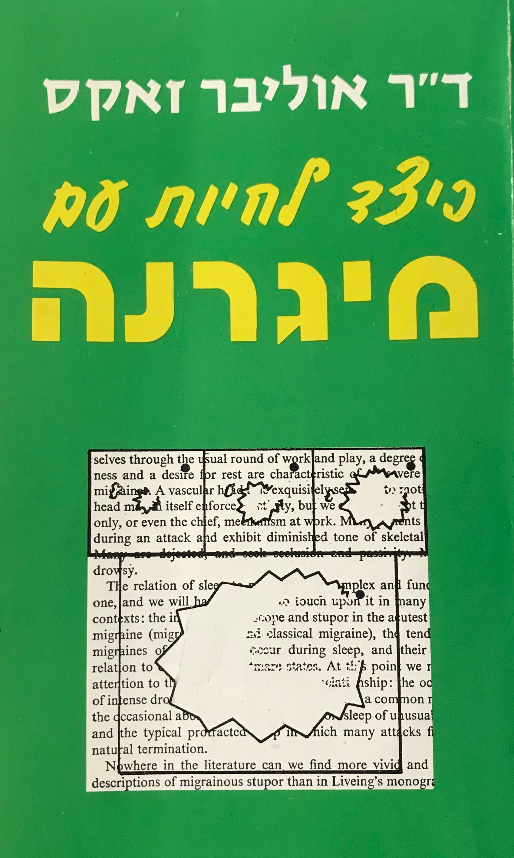 כיצד לחיות עם מיגרנה