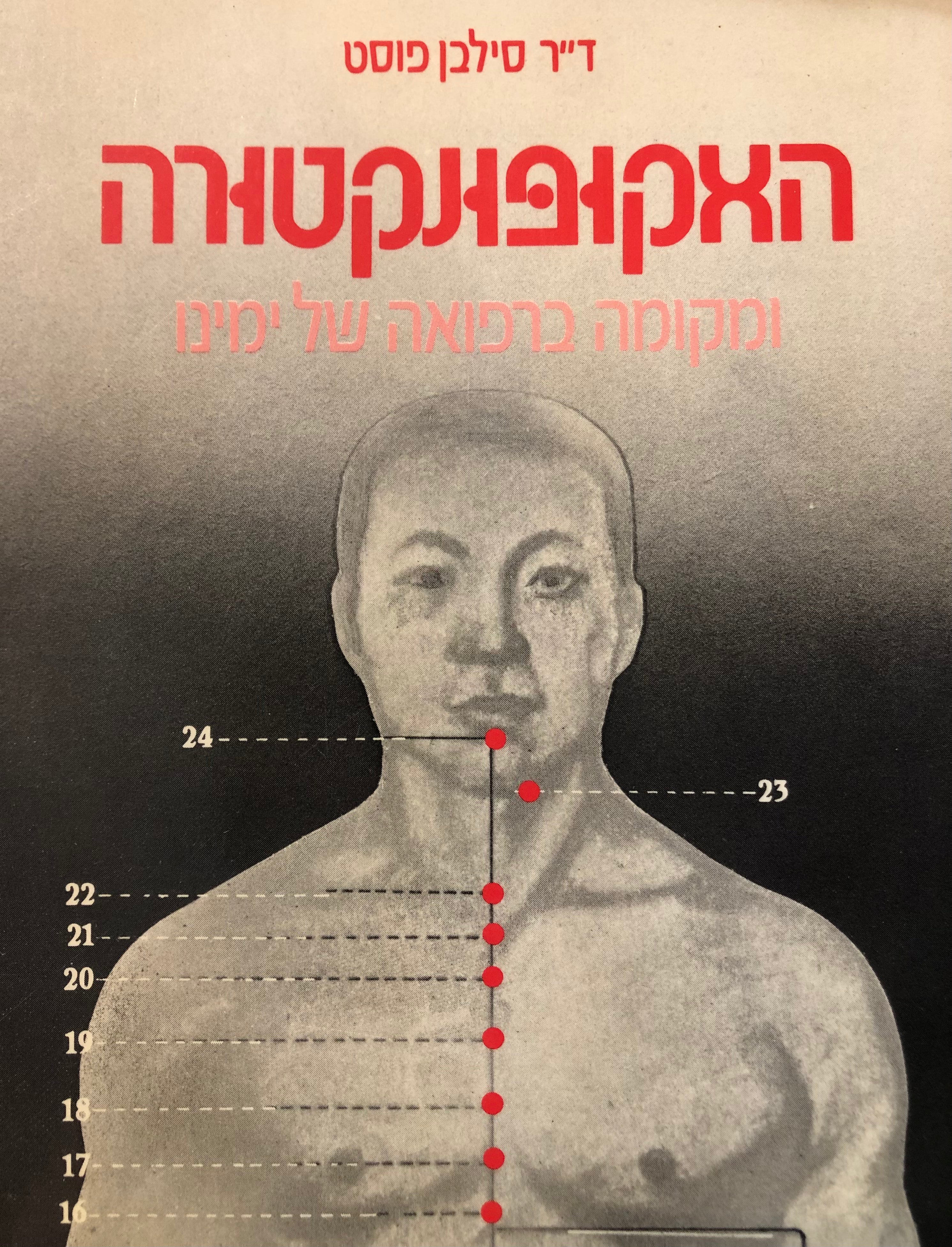 האקופונקטורה ומקומה ברפואה של ימינו
